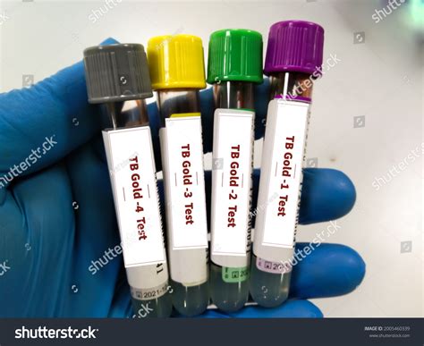 quantiferon tube color